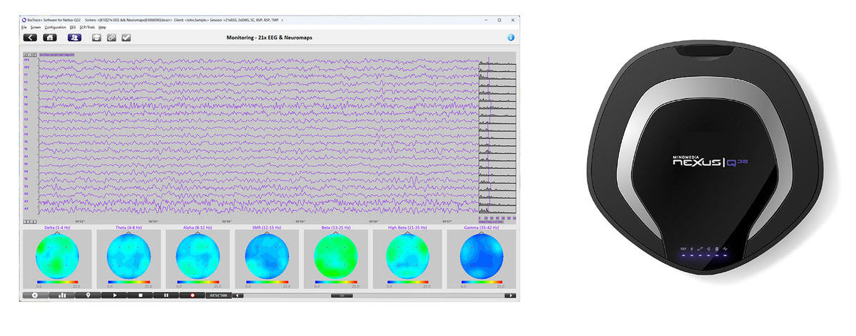 Nset Device BioTrace+ – NeXus | NSET Mind Media