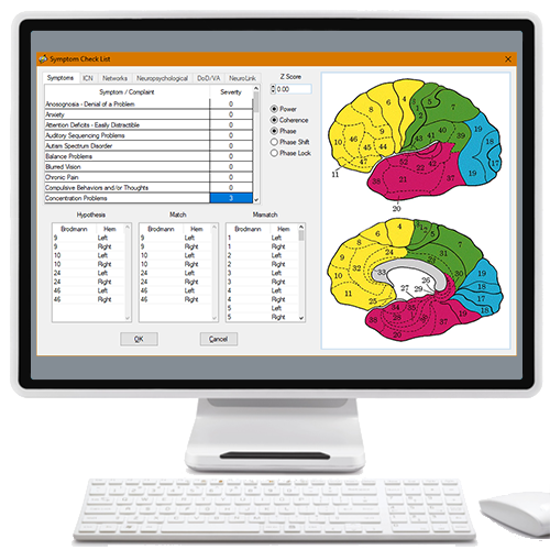 swLOR z-score Neurofeedback
