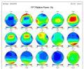 LD & TBI Discriminant Functions