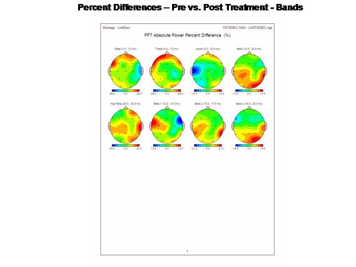 NeuroStat