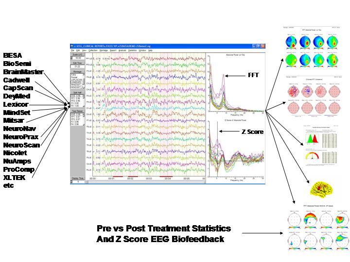 LD & TBI Discriminant Functions