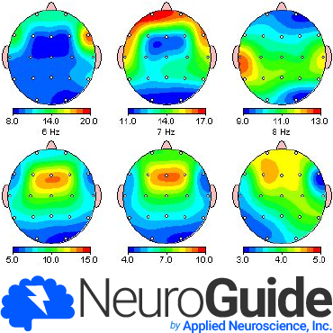 Neuroguide Software